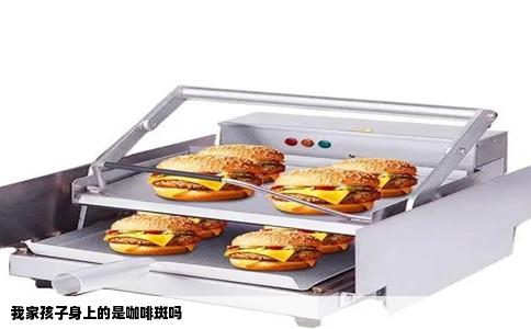 我家孩子身上的是咖啡斑吗